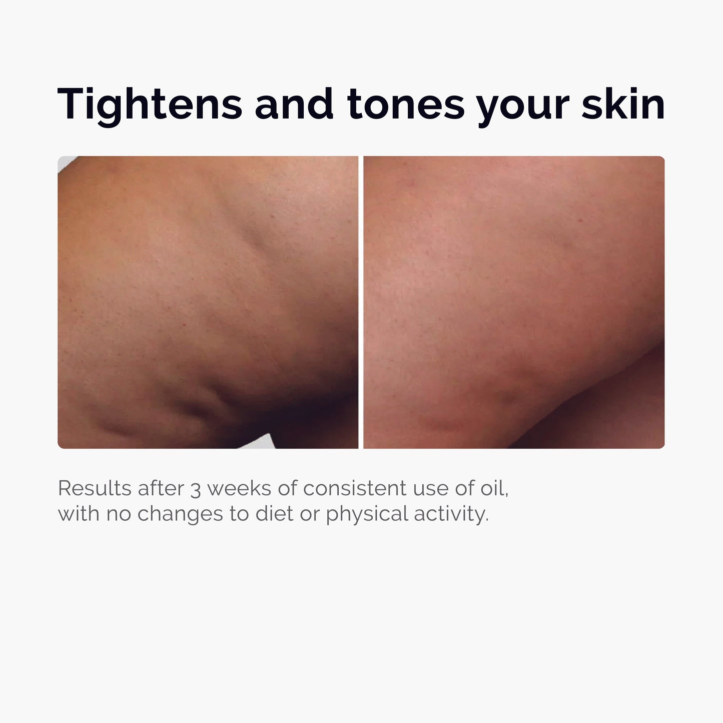 Toning & Tightening BodyOil™